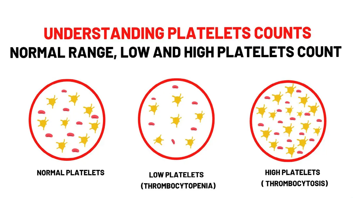 Platelet Count 3