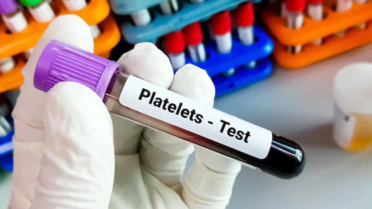 platelet count test 2